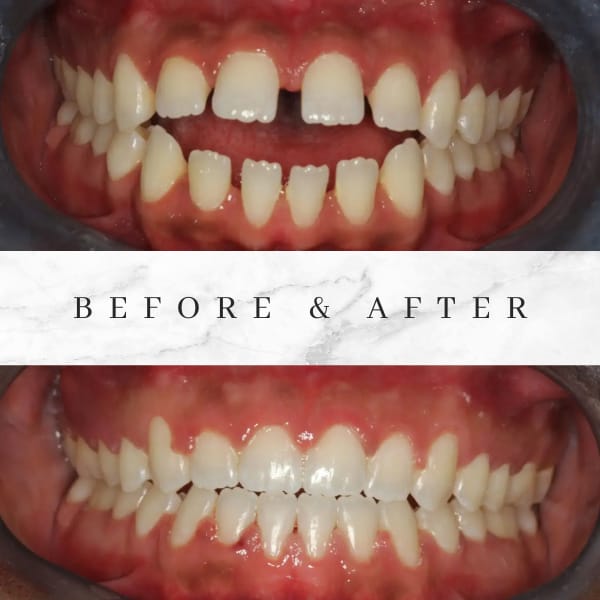 Before & After - Hair Treatment